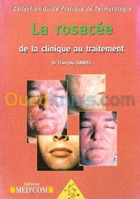La rosacée: de la clinique au traitement — vignette 2