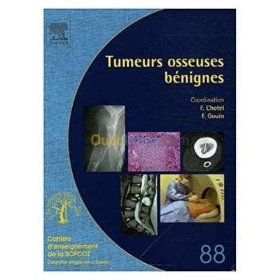 Tumeurs osseuses bégnines